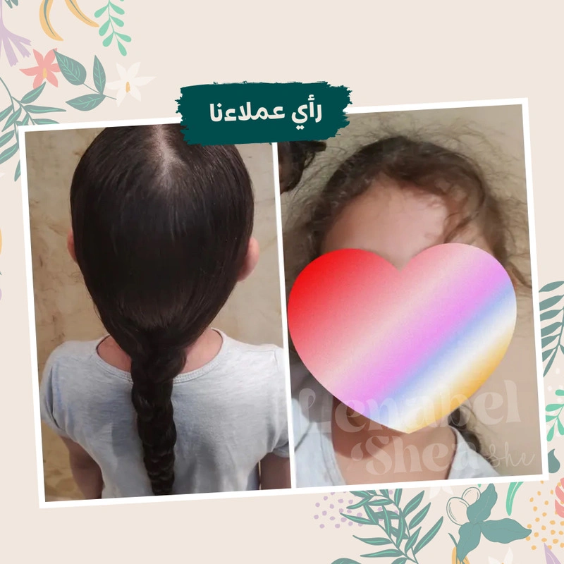 ⁦زبدة الشيا للتصفيف وعلاج هيشان و تقصف الشعر⁩ - الصورة ⁦9⁩