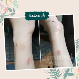 ⁦زبدة الشيا لترطيب البشرة والجسم⁩ - الصورة ⁦11⁩