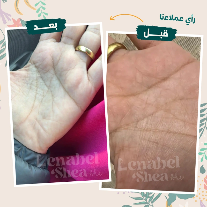 ⁦زبدة الشيا لترطيب البشرة والجسم⁩ - الصورة ⁦12⁩