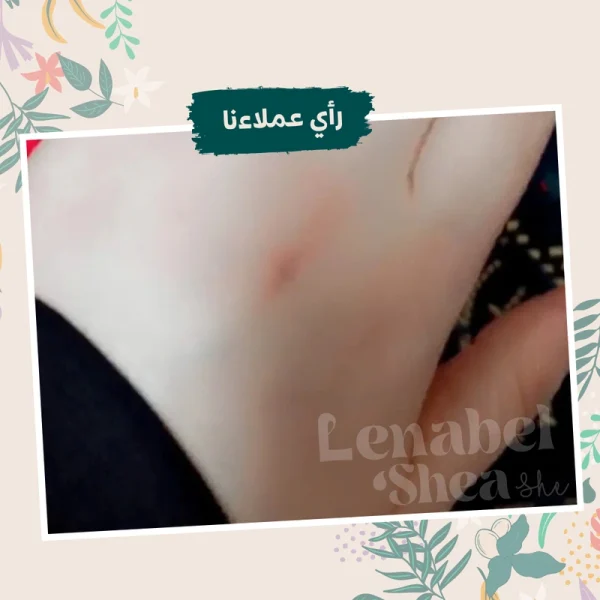 زبدة الشيا لترطيب البشرة والجسم